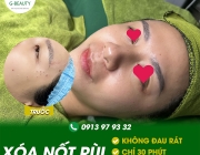 tham-my.jpg