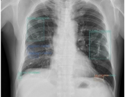 lung.png