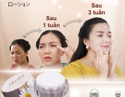 giai đoạn thay đổi.png
