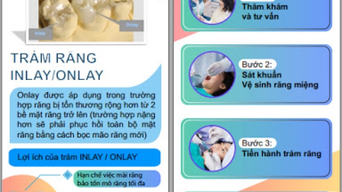 Thiết kế Brochure Tr&aacute;m răng