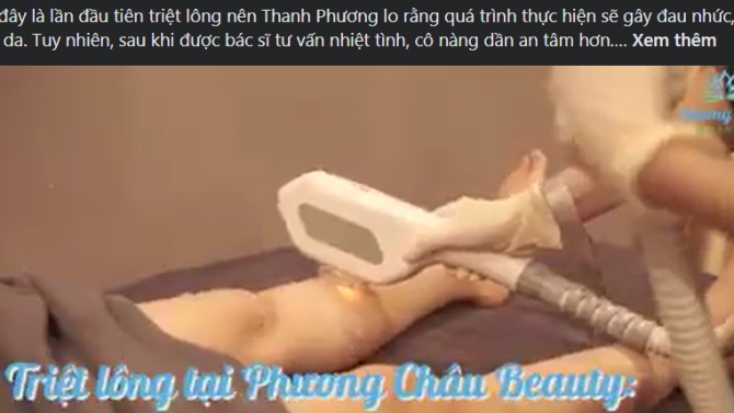 TRIỆT L&Ocirc;NG TẠI PHƯƠNG CH&Acirc;U BEAUTY - NHẸ NH&Agrave;NG, AN TO&Agrave;N, &Ecirc;M &Aacute;I!