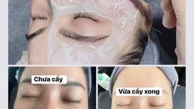 tư vấn chăm s&oacute;c da c&aacute; nh&acirc;n