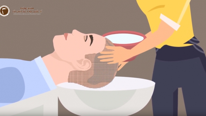 video hướng dẫn c&aacute;ch chăm s&oacute;c sau cấy gh&eacute;p