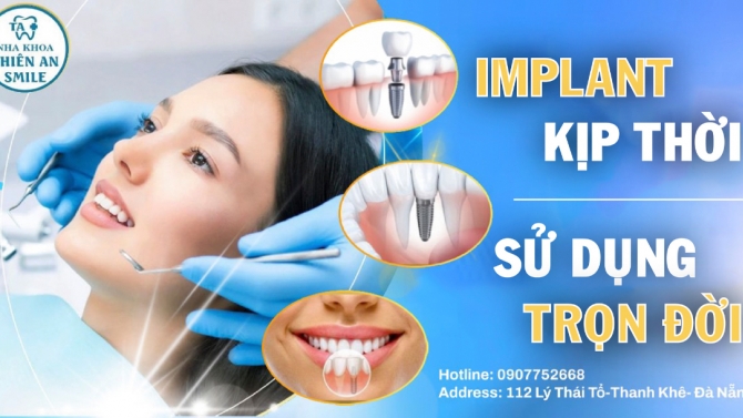 Thiết kế ảnh b&agrave;i viết Nha Khoa Thi&ecirc;n An Smile