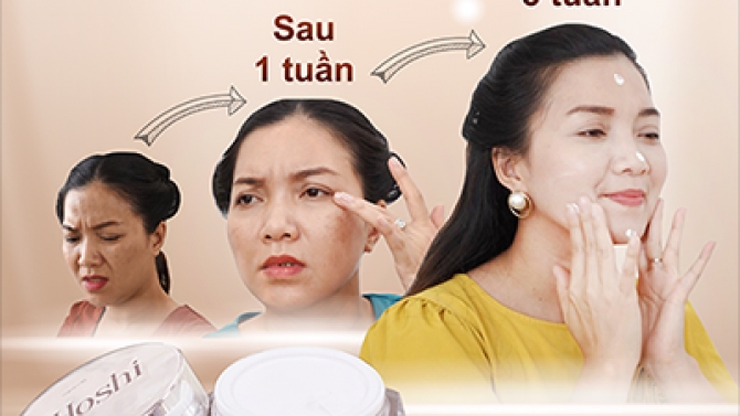 Quảng c&aacute;o mỹ phẩm Hoshi