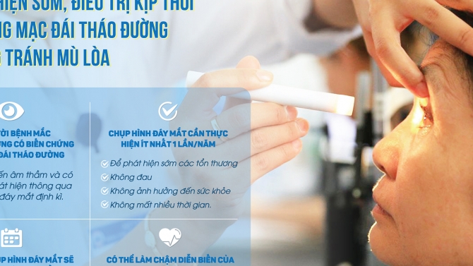 Thiết kế Poster