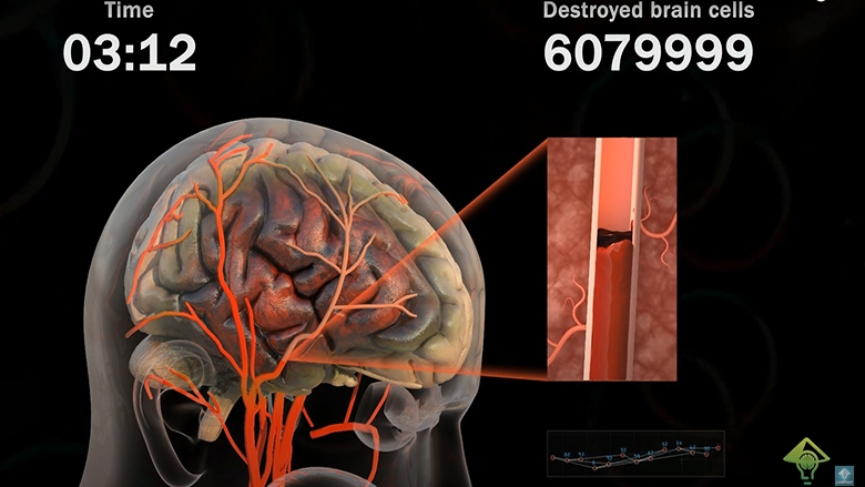Custom Medical Animation.jpg