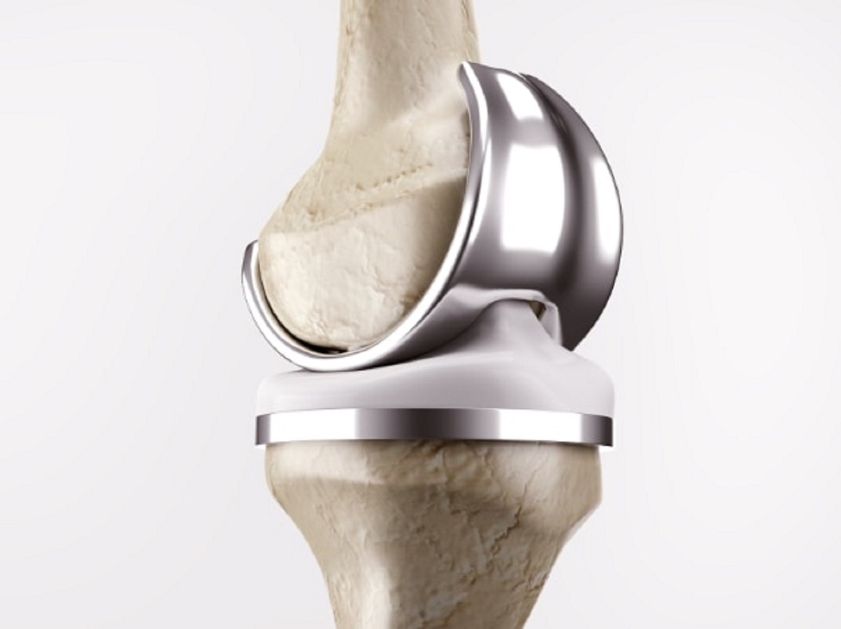 knee-implant-web_600x450px.jpg